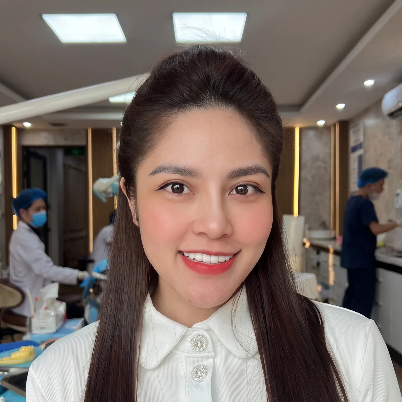 ảnh B-A khách veneer
