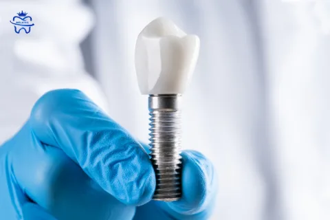 Why Does Bad Breath Occur After Dental Implant Surgery?